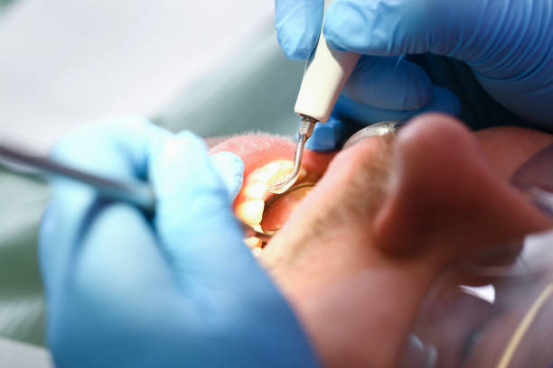 Best Emergency Denture Repair in Sissonville, WV