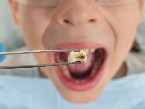 Best Weekend Emergency Dental Services in Sissonville, WV